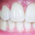 Polovina pětiletých dětí má zubní kaz